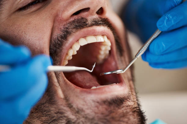 Best Emergency Treatment for Toothache in White City, OR